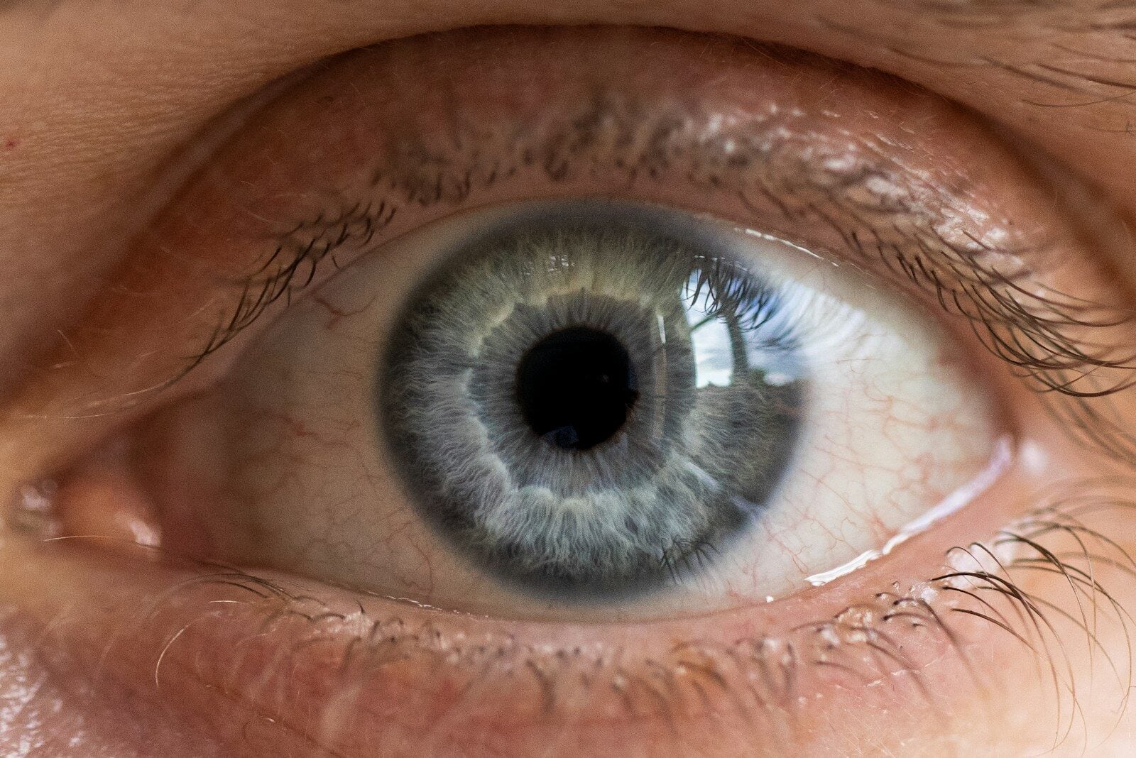Kies voor een laser ooglidcorrectie?